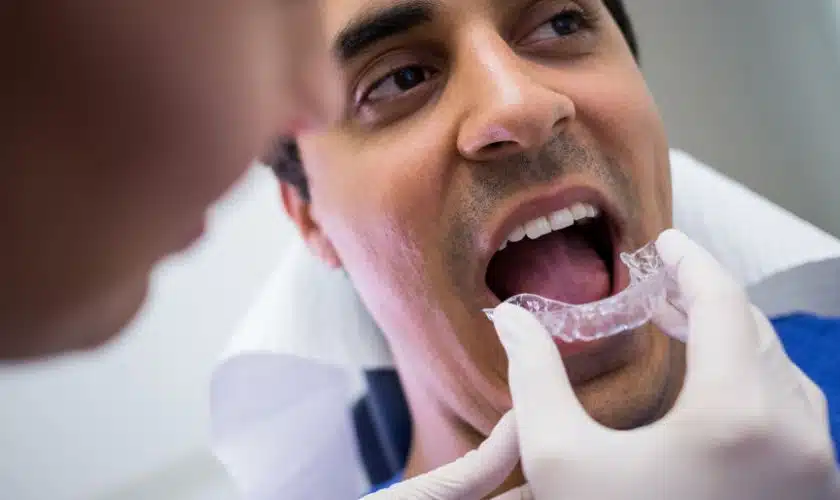 10 things To Know Before Starting An Invisalign Treatment