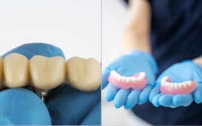 Filling the Gap: Dentures vs Bridges