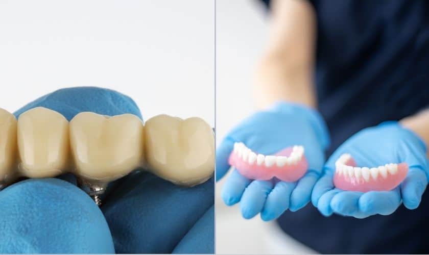 Filling the Gap: Dentures vs Bridges